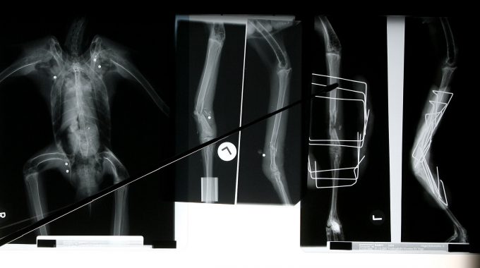 Das Röntgenbild Des Drei Monate Alten Schreiadlers "Sigmar", Der 2007 Auf Seinem Zug Nach Afrika über Malta Angeschossenen Worden War. Foto: Arno Burgi Dpa/lbn +++(c) Dpa - Report+++